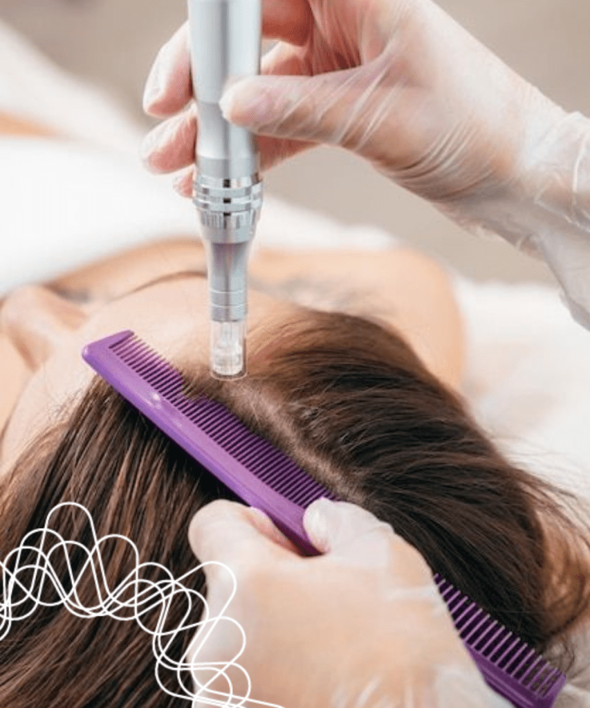 Microneedling protseduur juustele ja peanahale Ilupai Skincare salongis Pärnus